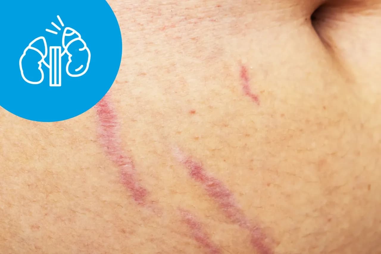 Zespół Cushinga – jakie badania potwierdzą diagnozę i co warto wiedzieć