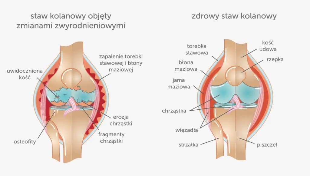 Ból kolan do jakiego lekarza? Sprawdź, kogo potrzebujesz!