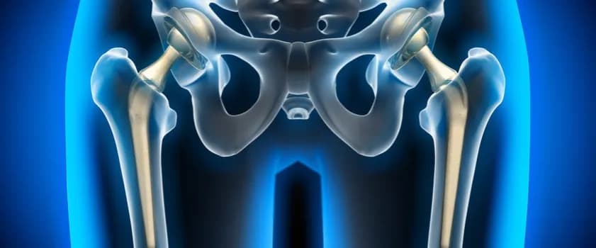 Czy ból biodra może promieniować do brzucha? Odkryj przyczyny i objawy