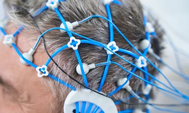 Co wykrywa badanie EEG? Kluczowe informacje o diagnozowaniu chorób