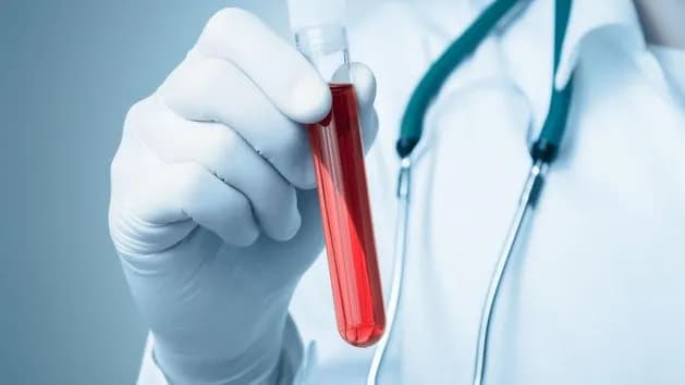 Co to jest HGB w badaniu krwi i dlaczego jest tak ważne dla zdrowia