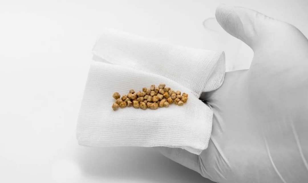 Jaki lekarz od kamieni w woreczku żółciowym pomoże uniknąć bólu?