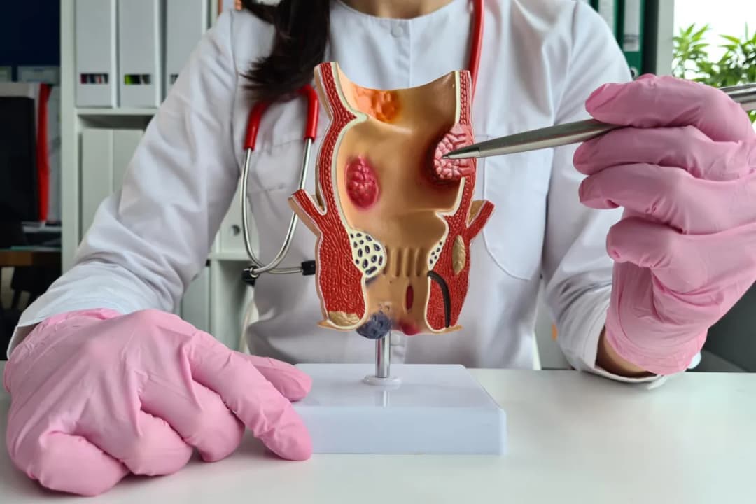 Choroba odbytu jaki lekarz? Dowiedz się, kiedy iść do proktologa