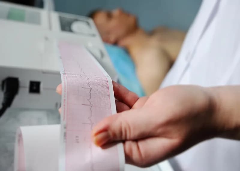 Ile kosztuje badanie EKG w Polsce? Ceny i porady na co zwrócić uwagę
