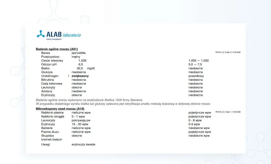 Ile siku do badania moczu? Kluczowe informacje o czasie i przygotowaniu