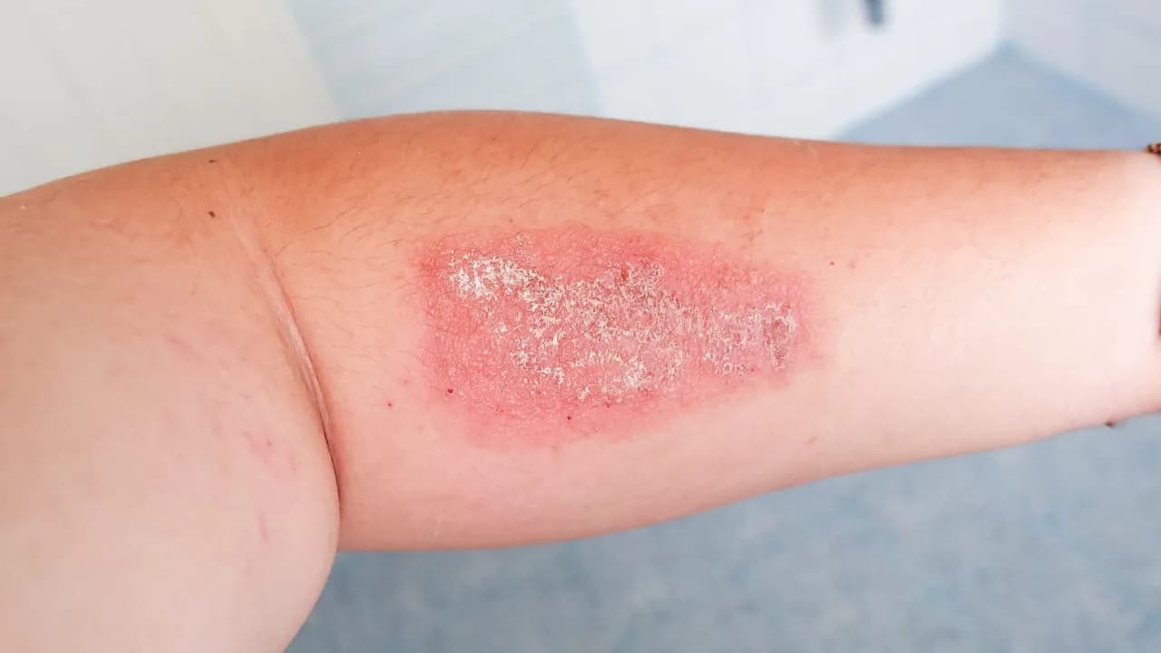 Jaki lekarz leczy gronkowca złocistego? Sprawdź, kogo wybrać