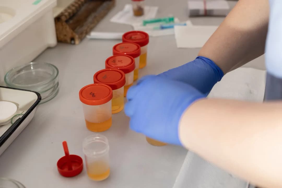 Jak przechowywać mocz niemowlaka do badania, aby uniknąć błędów