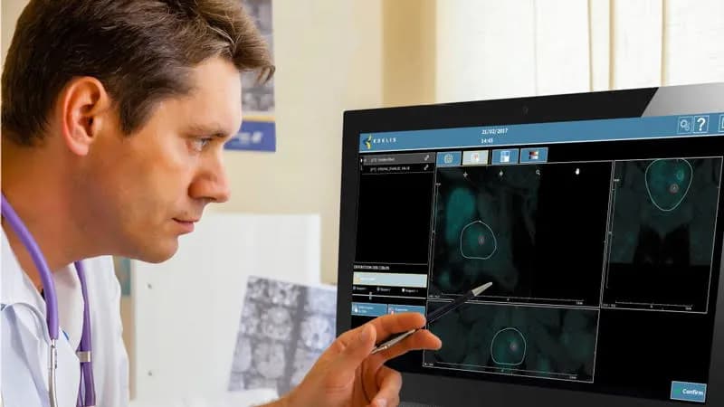 Ile kosztuje biopsja fuzyjna prostaty? Poznaj ceny i opcje finansowe