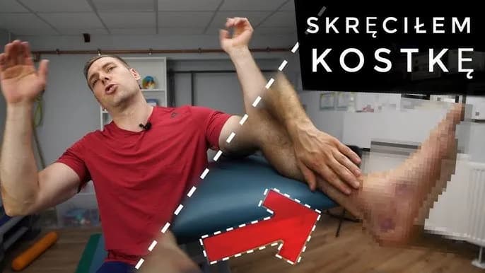 Ile się goi skręcona kostka? Poznaj czas regeneracji i rehabilitacji