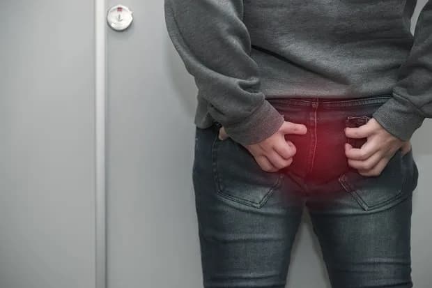 Skuteczne metody na ból odbytu – jak leczyć i uniknąć cierpienia