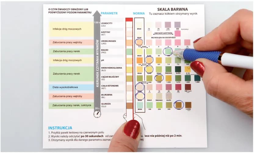 Czy badanie moczu wykryje zapalenie pęcherza? Kluczowe informacje o diagnostyce